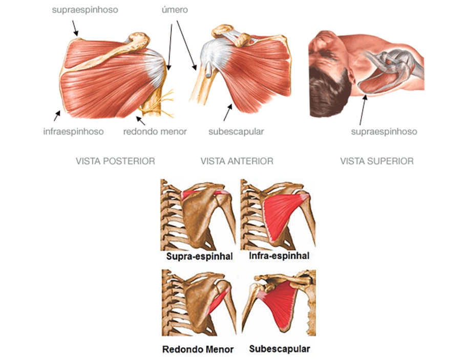 Sintomas e tratamento da lesão do manguito rotador